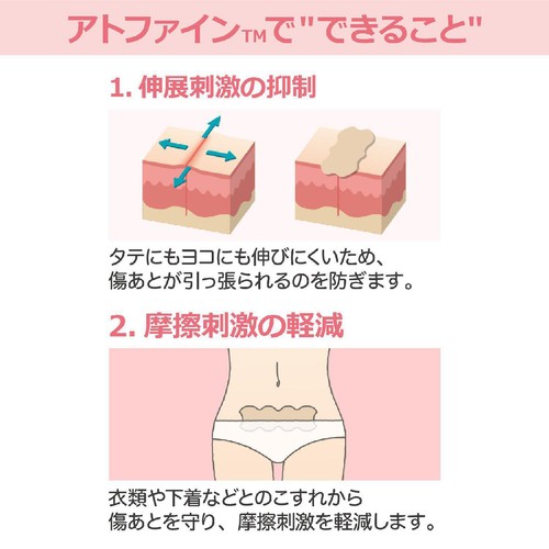ニチバン アトファイン 傷あとケアテープ Lサイズ 3枚