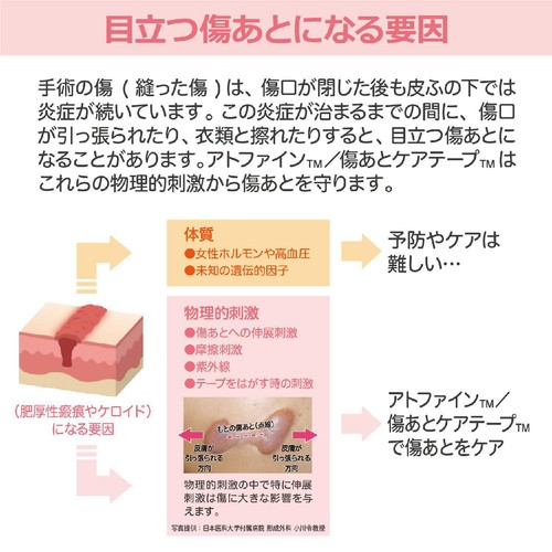 ニチバン アトファイン 傷あとケアテープ Lサイズ 3枚