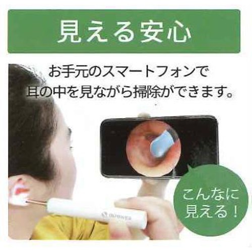 QIPOWER スマート耳かき QEー15 ホワイト 1個
